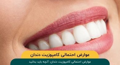 عوارض احتمالی کامپوزیت دندان: آنچه باید بدانید